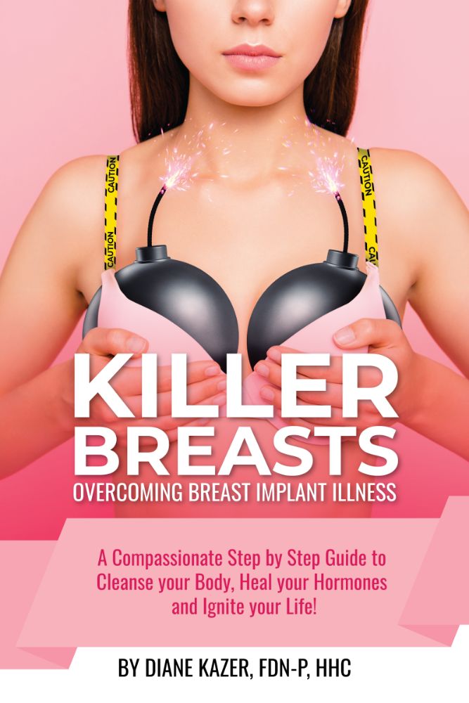 diane-kazer-breast-implant-illness-holistic-health-wellness-killer-breasts-book-cover